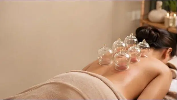 Cupping Therapy Cupping Therapy